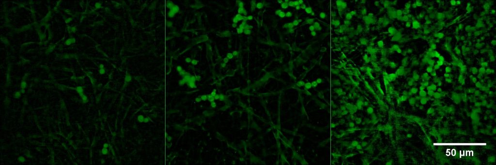 Časová sekvence kvasinek zachycená fluorescenčním mikroskopem